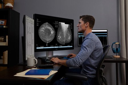 Hologic's AI mammography flagged a third of breast cancer cases missed in 7,500 screenings