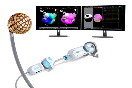 Kardium begins first commercial procedures with the Globe® Pulsed Field System, a breakthrough in atrial fibrillation treatment