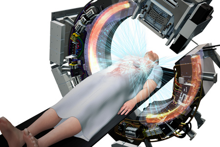 First clinical outcomes for SCINTIX therapy in lung and bone tumors unveiled by RefleXion Medical